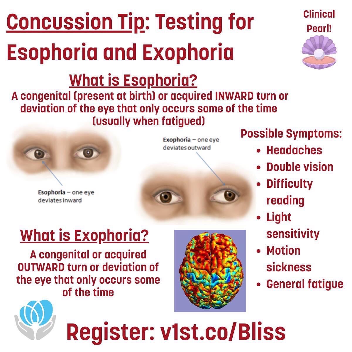 VestibularFirst's tweet image. Eye misalignment after concussion - is it contributing to your patient's headaches, difficulty reading, or fatigue? Learn more at our Jan 10th Journal Club or watch on-demand afterwards. Register v1st.co/Bliss #concussion #neurology #migraine #optometry #ophthalmology