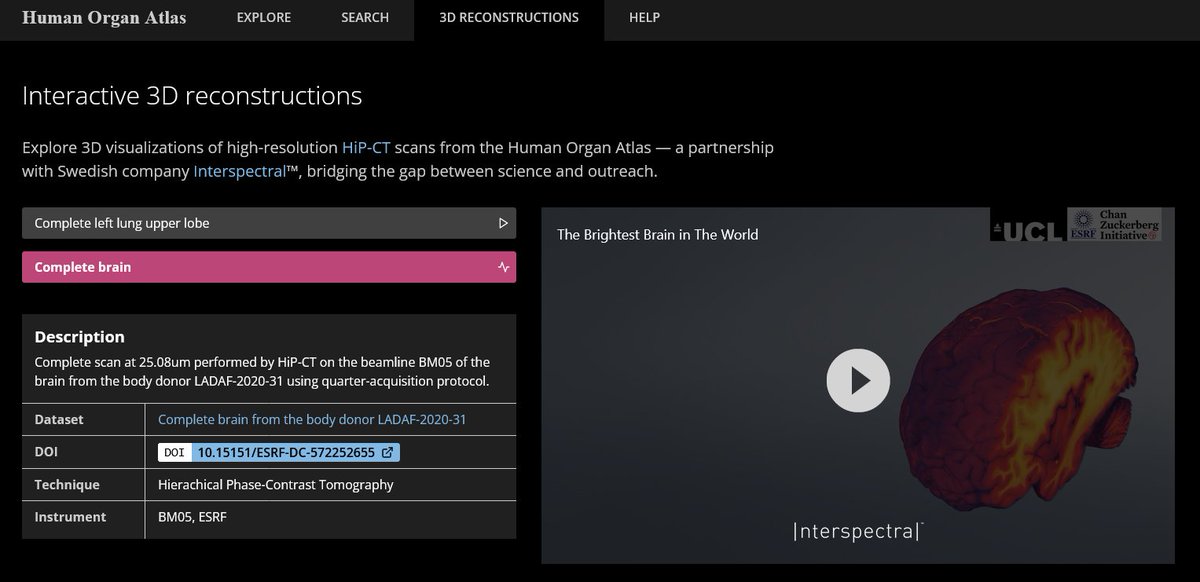 Andy Gotz (@andy_gotz) on Twitter photo interspectral.com/interactive-st… - the first 3d streaming service for the ‘Human Organ Atlas’ thanks to the teams <a href="/interspectral/">lilac</a> , <a href="/esrfsynchrotron/">European Synchrotron</a> and <a href="/hip_ct/">HiP-CT</a> (partly financed by <a href="/Panosc_eu/">PaNOSC</a> + <a href="/cziscience/">CZI Science</a>) interspectral.com/interactive-st… - the first 3d streaming service for the ‘Human Organ Atlas’ thanks to the teams <a href="/interspectral/">lilac</a> , <a href="/esrfsynchrotron/">European Synchrotron</a> and <a href="/hip_ct/">HiP-CT</a> (partly financed by <a href="/Panosc_eu/">PaNOSC</a> + <a href="/cziscience/">CZI Science</a>)