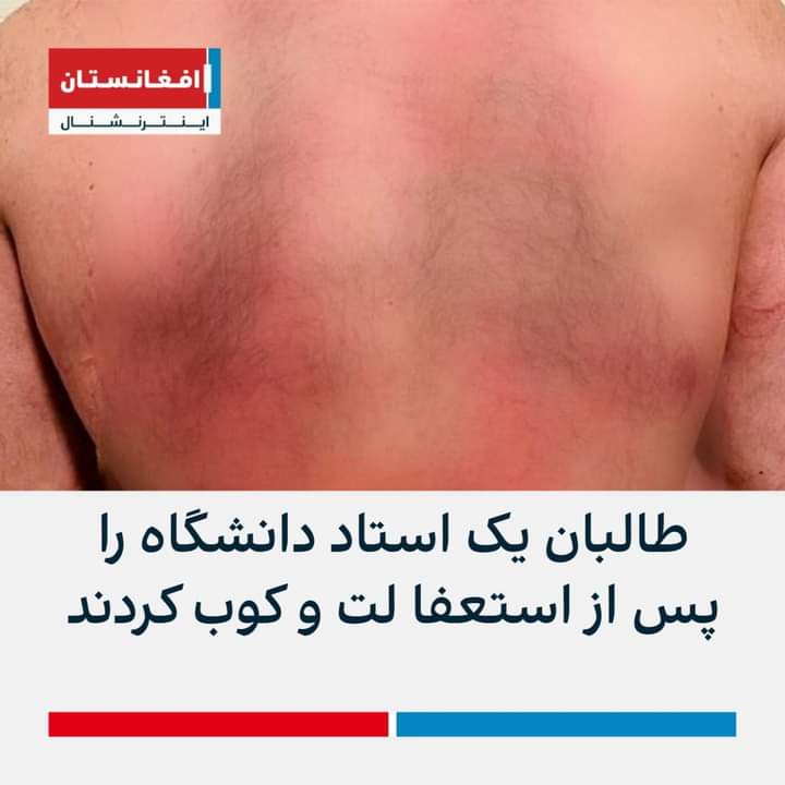 KeyarangSaadat's tweet photo. فقط نفس کشیدن اختیاری است و بس https://t.co/GYt2OScgRv