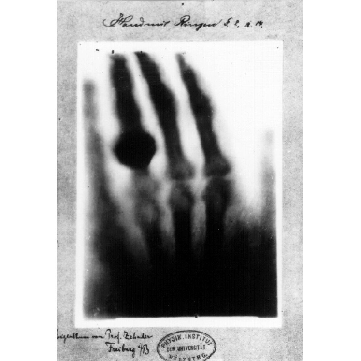 ARRS_Radiology's tweet photo. Wilhelm Roentgen took the first x-ray of a human—his wife, Anna Bertha Ludwig—on this day in 1895, just six weeks after discovering x-rays.⁠ https://t.co/cCxj2TnOpR