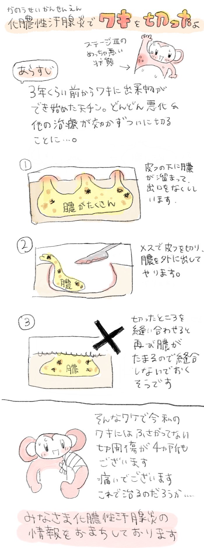 日本がん対策図鑑 | 【PD-L1陽性胃がん：一次治療（OS、PFS