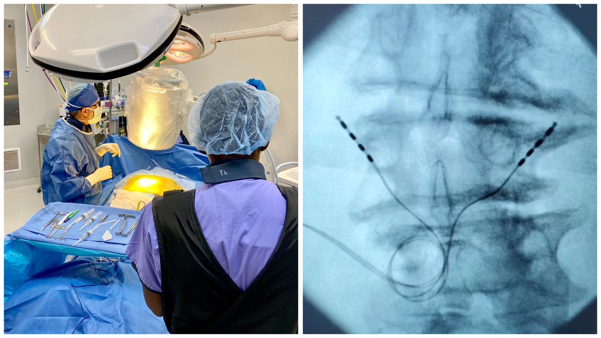 MainstayMedical's tweet photo. Dr. Andrew Khoury, from Advanced Spine and Pain Specialists, beginning to #ReActiv8 patients throughout Houston!
Thank you to @CMSGov for allowing patients to get the treatment they need.
#mainstay #reactiv8 #multifidusdysfunction #chroniclowbackpain #restorativetherapy https://t.co/34l0sPxt2T