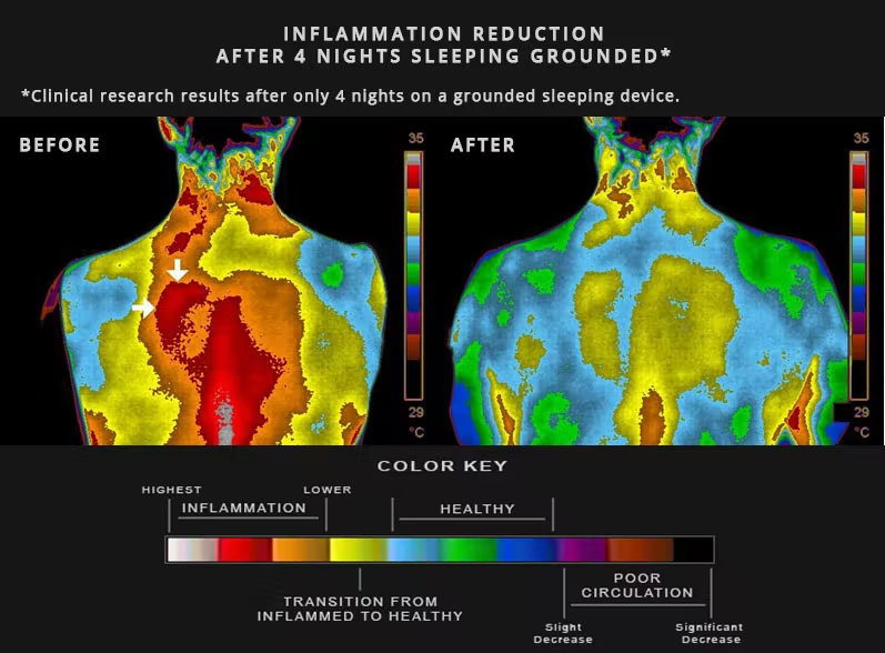 sleeping grounded to the earth massively reduces inflammation

this is why camping feels so good