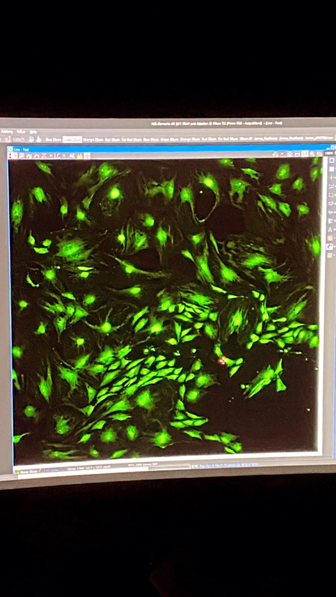Dila_htn's tweet photo. What makes your day better:
Good results of your experiments🤗
Trust your research!😉
#DoingPhD #PrimarySchwannCells #LiveDeadAssay #CellCulture #Biomaterials #Neuroscience #PeripheralNerve #Sinirbilim https://t.co/UFIfK6TZ6P