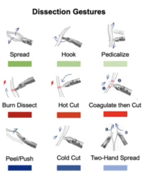 AjhungMD's tweet photo. Original #surgicalAI research @npjDigitalMed from our team 

✔️ surgical gestures are the building blocks of surgery
✔️ #AI uses gesture sequences to predict 12 mo  function outcome after surgery
✔️ Two all 🌟 AI teams verifying outcome
✔️Open access
https://t.co/Q6Uq5ixIpr https://t.co/maOuB3zlbD