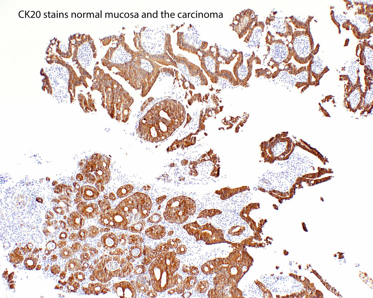 fanbotao on Twitter "RT science_press Small intestinal mucosa is CK7