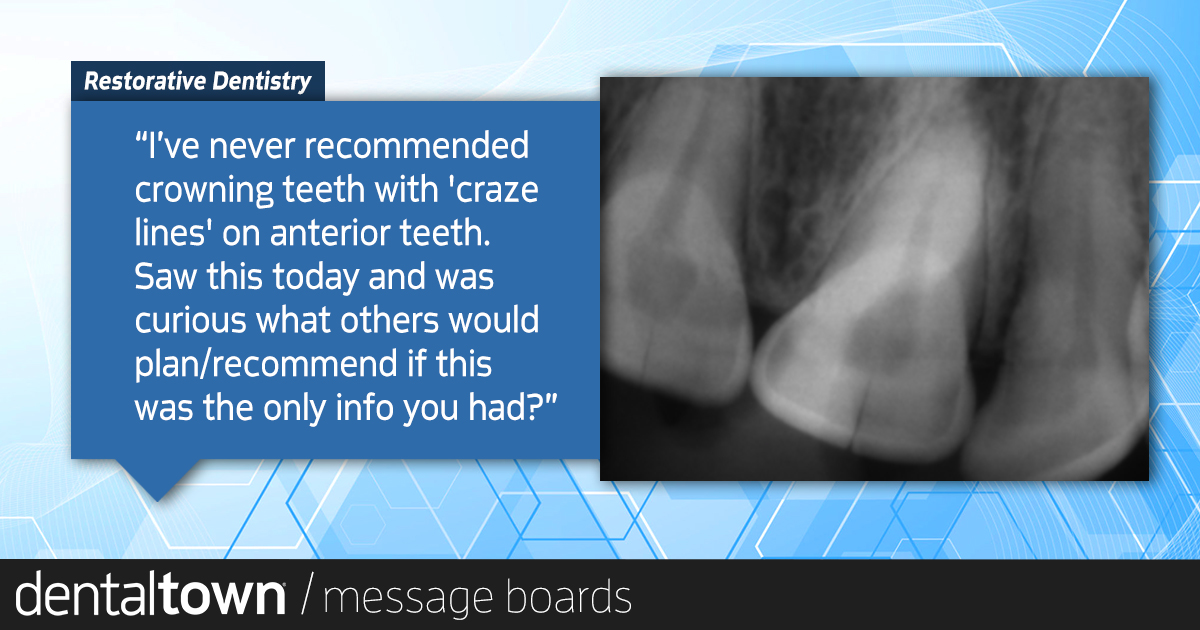 Dentaltown's tweet photo. Would you crown these teeth? Join the conversation at:
https://t.co/22uXXajkUJ https://t.co/HksFIesMoH