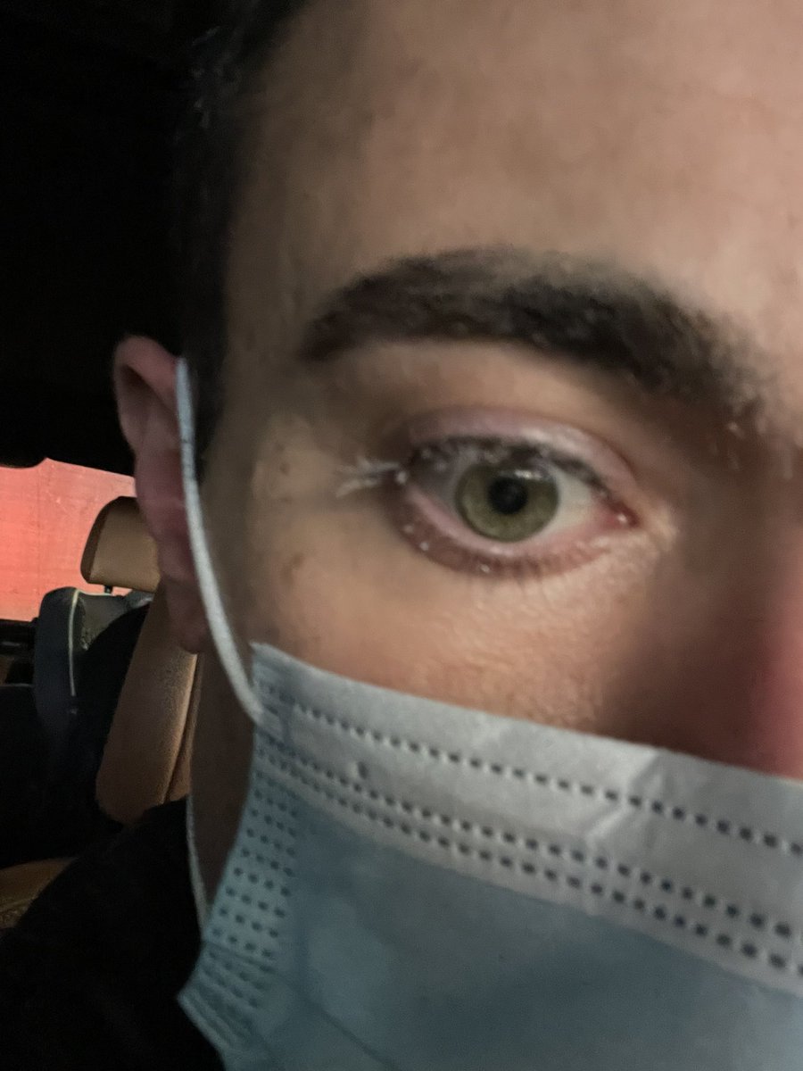 VipsMDMEd's tweet photo. #eyecicles 👁️ 🥶 https://t.co/TSB8akpZ98