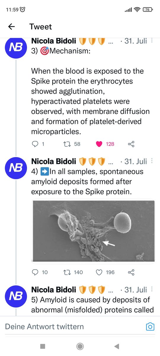 need_history's tweet photo. @SilviuMEftimie @invest_degen @drdenwalker I think so, the Spike-Protein is an foreign Protein and an toxic pathogen, our Immunsystem will not so easy tricked without Carrier molecule Lipid-Nanoparticles and destroy Spikes. A blood Transfusion with high quantities of SC2 Spikes is may be different story. https://t.co/VVCIO8aXQF