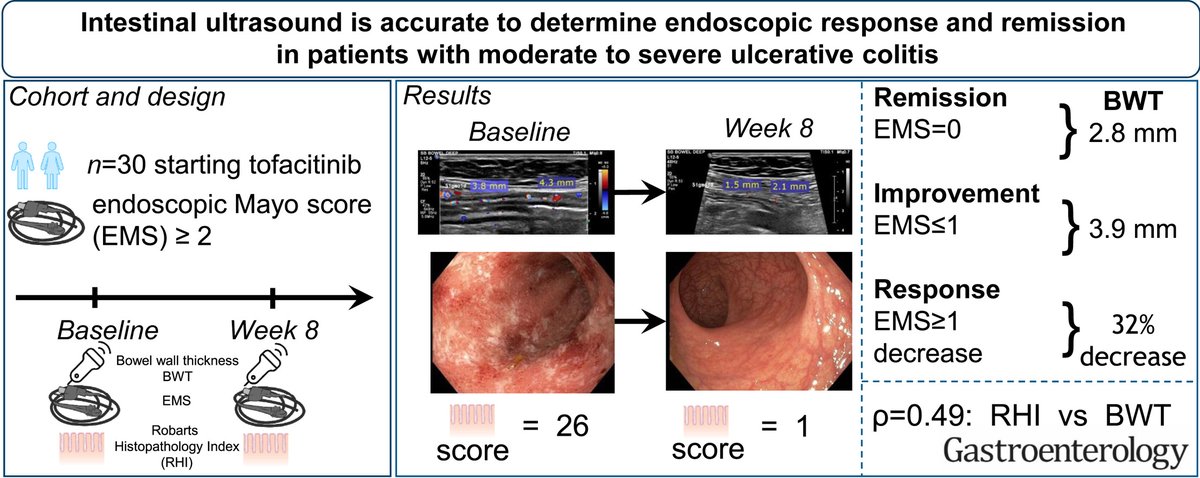 Intestinal Ultrasound Is Accurate to Determine Endoscopic Response and Remission in Patients With Moderate to Severe Ulcerative #Colitis: A Longitudinal Prospective Cohort Study ow.ly/5Sbh50M518c