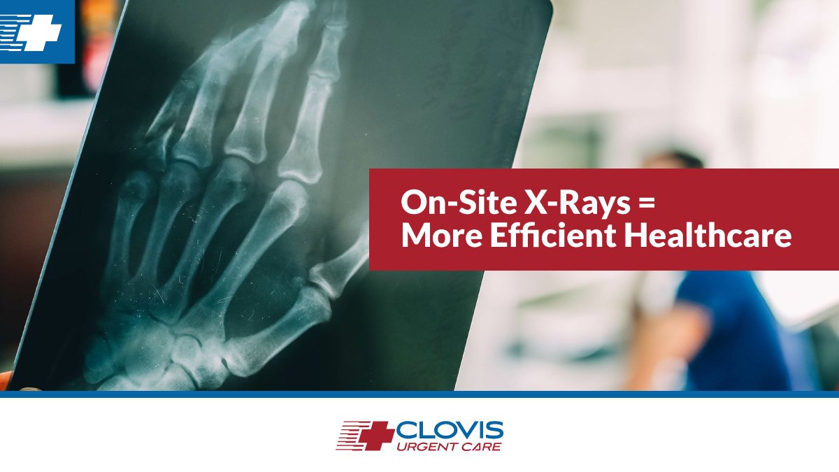 ClovisCare's tweet photo. We love being able to offer our patients a more complete healthcare experience by having many services under one roof. Get urgent care, labs, and x-rays all in one convenient location by calling us at (559) 324-7001.
#clovis #clovisurgentcare #onsitelabs #onsitexrays #urgentcare https://t.co/3aFP1cuDOy