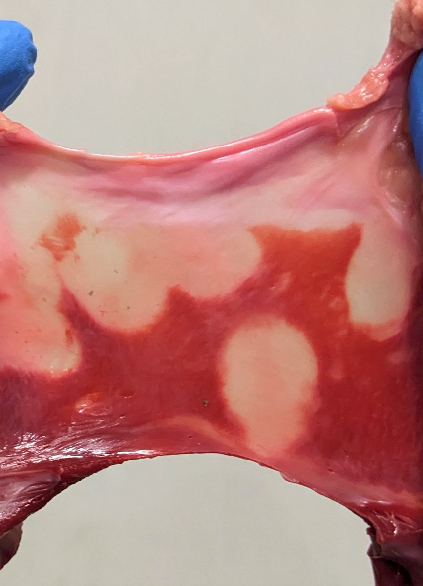 Great teamwork while we continue to develop research about Pulsed Field Ablation (PFA) mechanisms.
An example of chronic lesions after focal ablation in the Superior Vena Cava (SVC) in swine.
Our public reseach is funded by @MSCActions <a href="/AgEInves/">Agencia Estatal de Investigación</a>