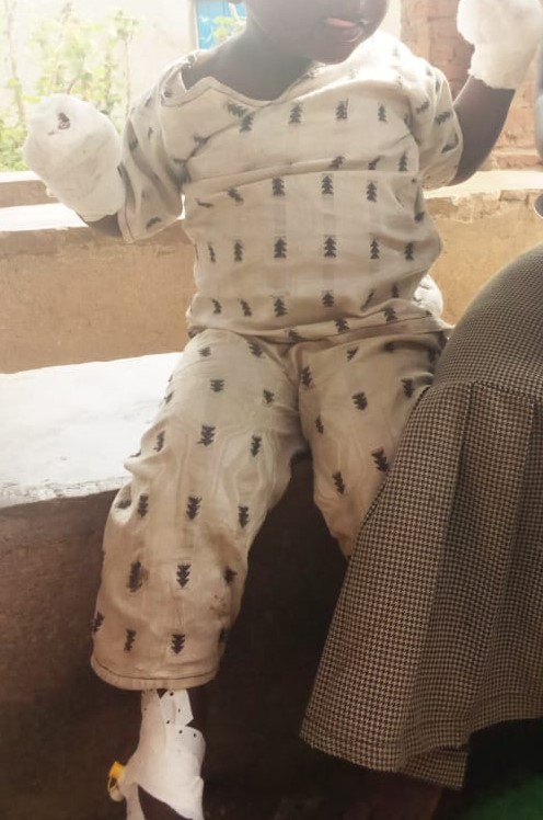 RT_Isanganiro's tweet photo. Une femme habitant #Rutumo de @RumongeProvince est ds les mains de la police depuis ce 3di. Elle est accusée d'avoir brûlé à l'eau bouillante les doigts de son enfant de 3ans qui aurait mangé tout le dßner familial. Les défenseurs des dts des enfants demandent justice.#Burundi https://t.co/Cwo1Mg1UAd