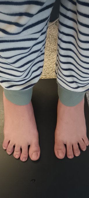 #feetpics https://t.co/mmZi4OQO1D<a href="/tag/feetpics"class="tags">#feetpics</a>