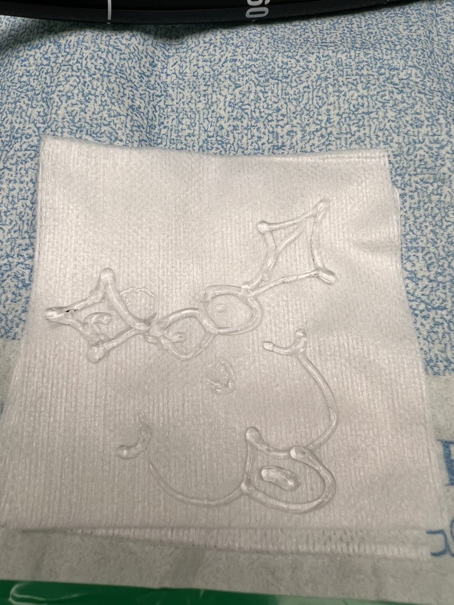 EUSandEndoscopy's tweet photo. Happy holidays from the staff at #PorterHospital Center for Advanced Therapeutic Endoscopy where the #GINurses and #GITechs are also #LubeArtists https://t.co/c0q8eLSPiH