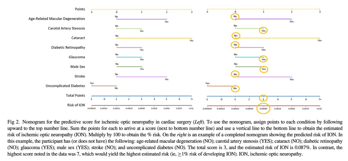 👉A predictive model for #ischemic # #opticneuropathy during cardiac surgery including age-related macular degeneration, diabetic retinopathy, carotid artery stenosis, cataract, glaucoma, uncomplicated diabetes type 2, stroke, age, male sex was validated
jcvaonline.com/article/S1053-…