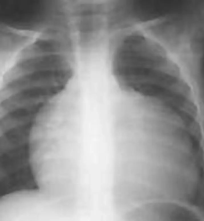 maryagemima's tweet photo. hello everyone, I am here humbly knocking to your kind &amp; merciful hearts to help us pool funds for my papa's medication. He was diagnosed with Cardiomegaly. A heart failure where the heart is enlarged/dilated due to a lesion of the heart muscle. + https://t.co/EUQlbSjen0
