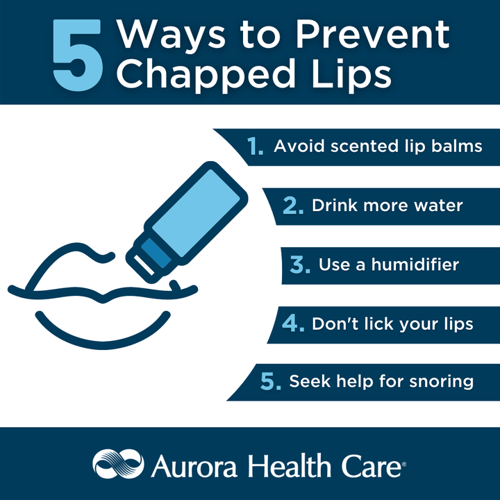 Aurora Health Care on Twitter "Besides the cold weather, there are many reasons why you may