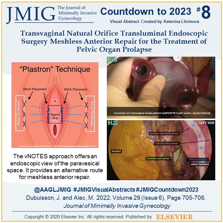 AAGLJMIG's tweet photo. 8️⃣: “Transvaginal Natural Orifice Transluminal Endoscopic Surgery Meshless Anterior Repair for the Treatment of Pelvic Organ Prolapse”: 🎦 article illustrating #vNOTES for meshless anterior #POP repair using a vaginal plastron➡️https://t.co/HgWnmcAnnA #JMIGCountdown2023 https://t.co/9xYWXsYWaG