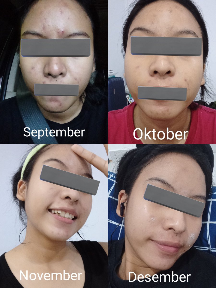 BokutoIsAnAngel's tweet photo. Lama kaga buka ini twitter, dan saatnya aku ngeshare ini

:) Perjalanan 4 bulan terakhir di 2022, melawan breakout https://t.co/SvGh0I0r0y