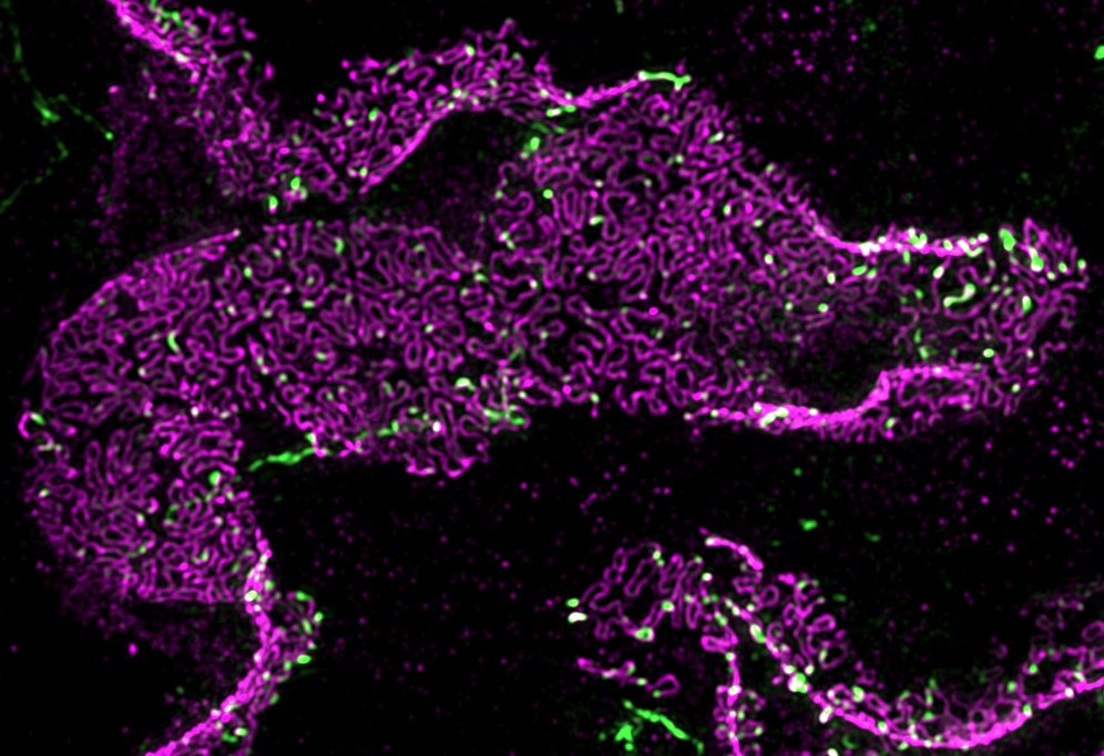 Our review, done by my group @UMGreifswald @Siegerist & @NIPOKA_Podocyte is accepted @KargerPublisher Glomerular Diseases! Here we share the latest aspects of the revolutionary super-resolution microscopy–a technique that revolutionizes research & diagnosis of glomerulopathies!