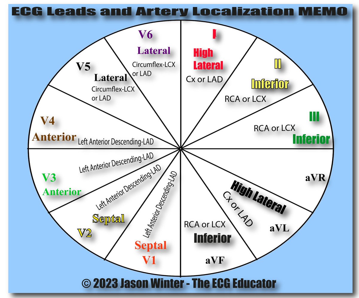 The ECG Educator 🩺 🫀 (@jasonwinterecg) on Twitter photo 