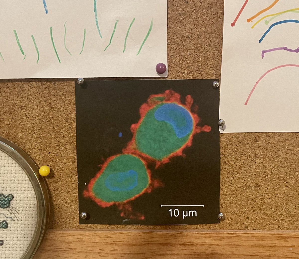 LouiseAJ1's tweet photo. Feeling chuffed on this #FluorescenceFriday that Master 5.7yr old still wants my confocal image of a #dendritic cell on his bedroom notice board. Indoctrinate ‘em young! #sciencemum https://t.co/hgeJoC5WK4