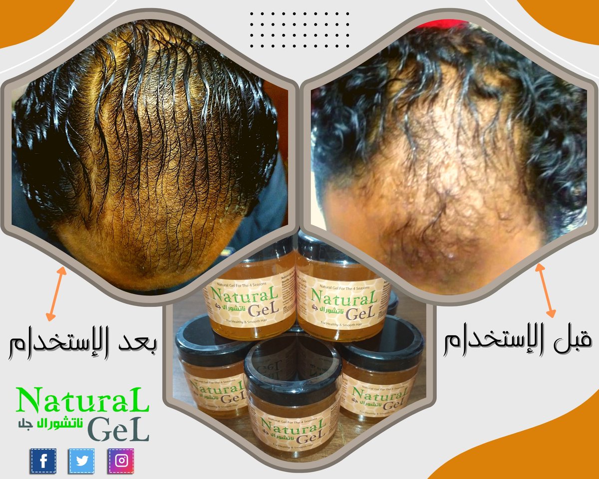 Natural_Gel's tweet photo. شايفين #ناتشورال_جل_بعسل_النحل 🧴🍯 بيعمل إيه 💪🏼

هو ده ناتشورال جل 🧴 يا جماعة 💪🏼

وبفضل الله هي دي #نتائج ناتشورال جل 🧴 بعسل النحل 🍯 

"تابع #الصورة"☝🏼

بإذن الله #هنغير_فكرة إن #الجل_بيوقع_الشعر،

عندنا #جل_الشعر_بيغذي_الشعر وله #فوائد_كتييير_جدا 💪🏼 https://t.co/zXErW5F3sb
