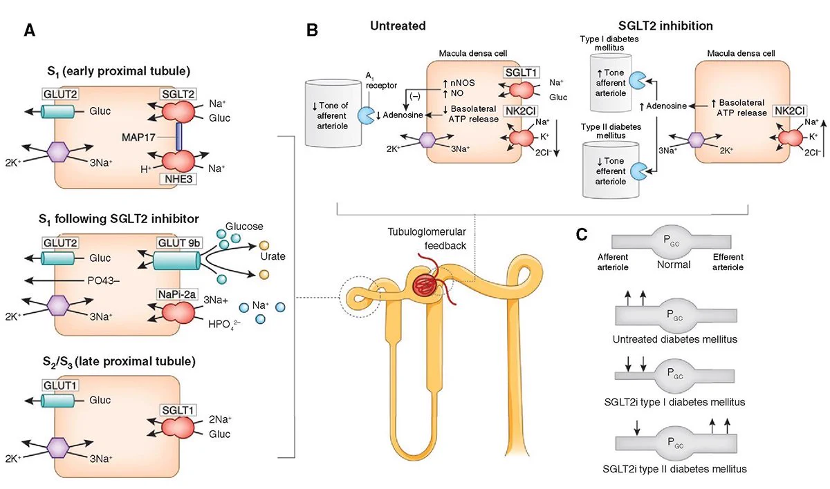 Mechanism of glucose transport in the proximal tubule and effects of sodium-glucose cotransporter 2 (SGLT2) inhibition on the tubuloglomerular feedback mechanism and transport of uric acid and phosphate.