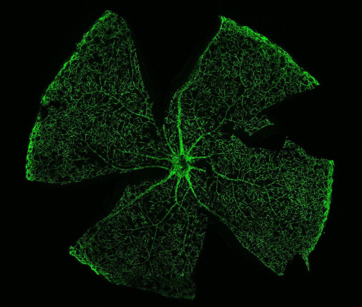 HullemanLab (@hullemanlab) on Twitter photo GFAP-positive mouse glial cells imaged by <a href="/StefPhDaniel/">Steffi Noelle Daniel, Ph.D.</a> look almost like fireworks cell-ebrating the New Year. <a href="/UTSWOphth/">UT Southwestern Ophthalmology</a> #FluorescenceFriday GFAP-positive mouse glial cells imaged by <a href="/StefPhDaniel/">Steffi Noelle Daniel, Ph.D.</a> look almost like fireworks cell-ebrating the New Year. <a href="/UTSWOphth/">UT Southwestern Ophthalmology</a> #FluorescenceFriday
