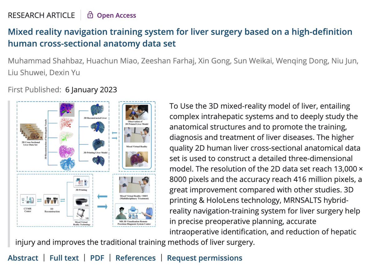 drmsurg's tweet photo. @CancerMedicineJ Cancer Medicine SCI IF 4.8 published our State of the art work https://t.co/Q11WsWSynr Mixed reality navigation training system for liver surgery based on a high‐definition human cross‐sectional anatomy data set”. Great pleasure to be First Author. https://t.co/okqrQ1sCWp