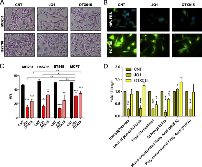 JournalofExper1's tweet photo. New study!💣

BETi enhance ATGL expression and its lipase activity to exert their antitumoral effects in #triplenegativebreastcancer (TNBC) cells

Look here👇
https://t.co/PwyjBHrNTG

#BETinhibitors
#LipidMetabolism
@IREISGufficiale https://t.co/632soSF16y
