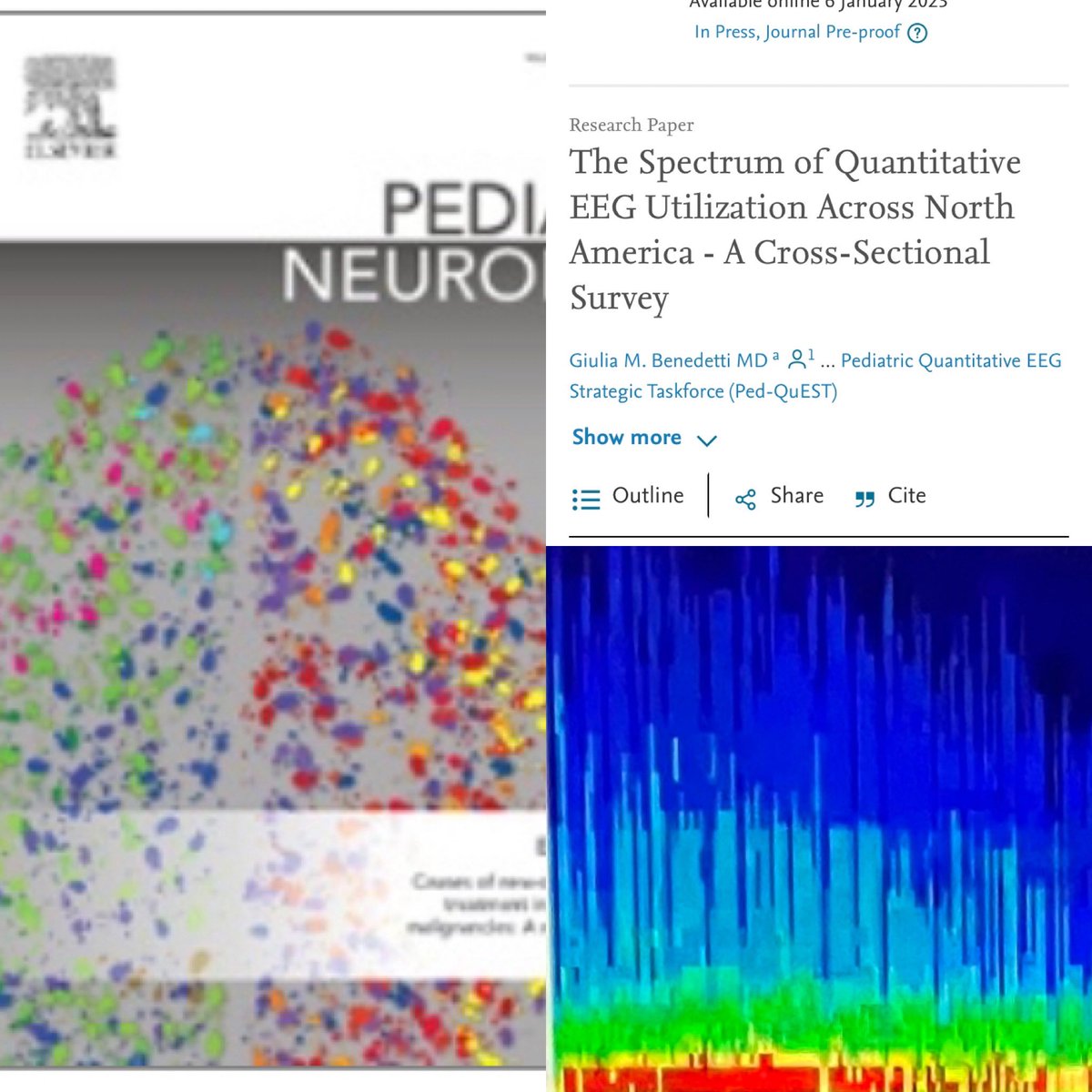 Giulia Benedetti (@giuliabene16) on Twitter photo >50% of MDs surveyed use qEEG when caring for critically ill kids w/neurologic disease; almost all who use qEEG endorse it enhances the care they provide. Let’s keep growing in our understanding of this powerful tool! <a href="/Dr_Press/">Craig Press</a> <a href="/Dr_RishiGanesan/">Rishi Ganesan, MBBS MD DM FACNS</a> <a href="/KerriLarovere/">Kerri LaRovere MD, MMSc</a> <a href="/DanaHarrar/">Dana Harrar</a> >50% of MDs surveyed use qEEG when caring for critically ill kids w/neurologic disease; almost all who use qEEG endorse it enhances the care they provide. Let’s keep growing in our understanding of this powerful tool! <a href="/Dr_Press/">Craig Press</a> <a href="/Dr_RishiGanesan/">Rishi Ganesan, MBBS MD DM FACNS</a> <a href="/KerriLarovere/">Kerri LaRovere MD, MMSc</a> <a href="/DanaHarrar/">Dana Harrar</a>