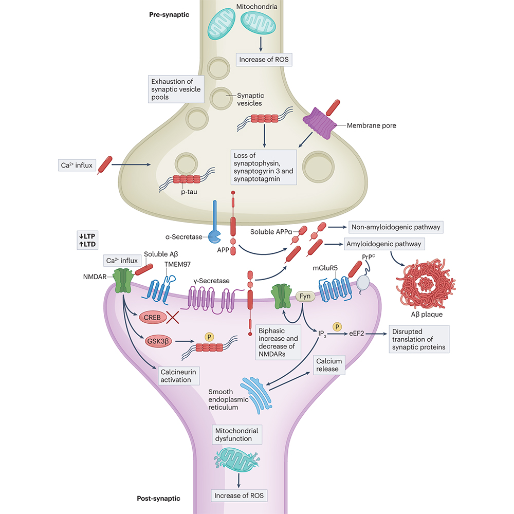 NaturePortfolio's tweet photo. A Review in @NatRevNeurol reviews our current understanding of the mechanisms underlying synaptic degeneration in Alzheimer disease and highlights key questions that still need to be answered. https://t.co/msQ1ApBR9P https://t.co/TPazHXh7u7
