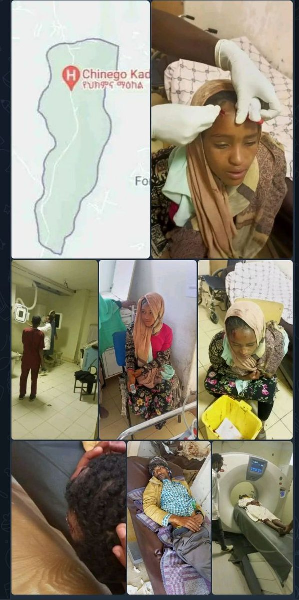በደቡብ ክልል በሀድያ እና በስልጤ ዞን ድንበር በሚገኘው በሊሙ ወረዳ በጭንጎ ቀዴ ቀበሌ የአክፍሮት ሀይላት በዓልን ሽፋን በማድረግ በቀበሌው ባሉ ሙስሊሞች ላይ ትንኮሳ እና ጥቃት አድርሰዋል::
ብታርፉ ይሻላችኀለ!