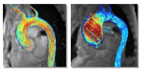 vass_vassiliou's tweet photo. 8/n 

and the rest of the programme! 
covering really EVERYTHING in relation to #whycmr

w masses @LuigiaDerr LV hypertrophy @gkoromia pseudoaneurysms @ValNikolaidou stress CMR @EylemLevelt 3D CMR @mgwfriedrich CMR changing practice @mugander ischaemia in AS @ThomasTreibel https://t.co/xE4q35PlY4