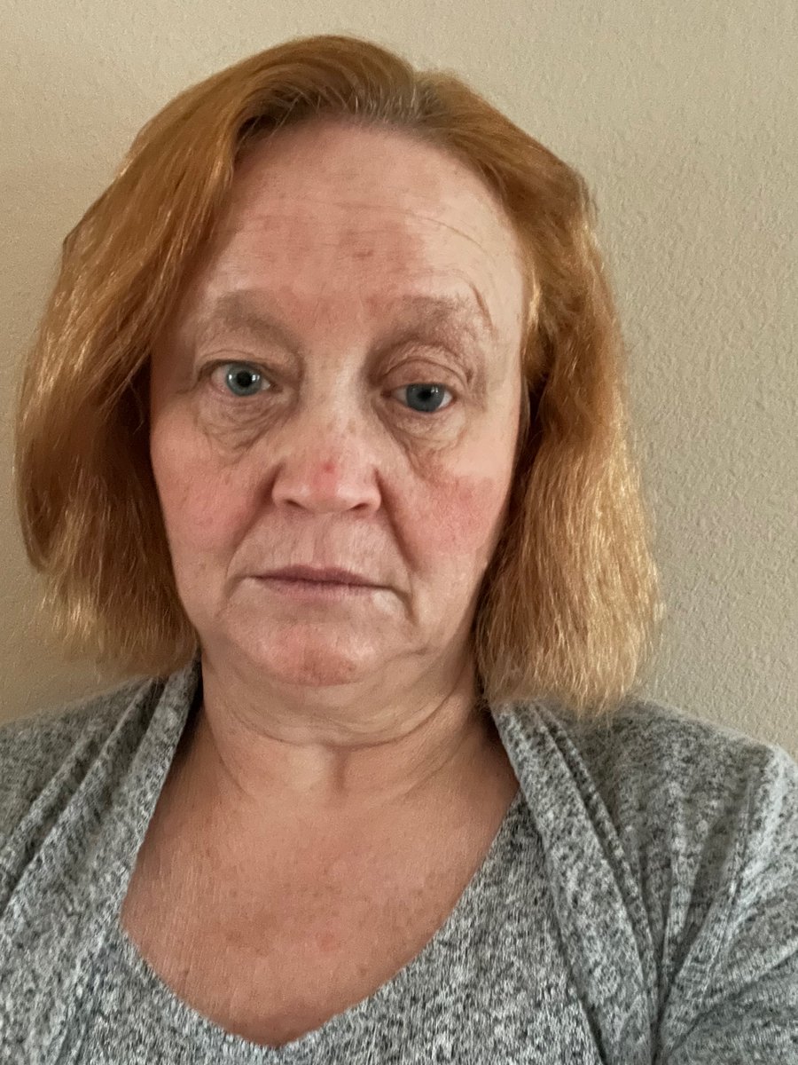 vanharris62's tweet photo. Botox is past due. See how my right shoulder is jacked up? It’s because of very tight muscles. Come on Jan 19. https://t.co/CDwQSbpeUt