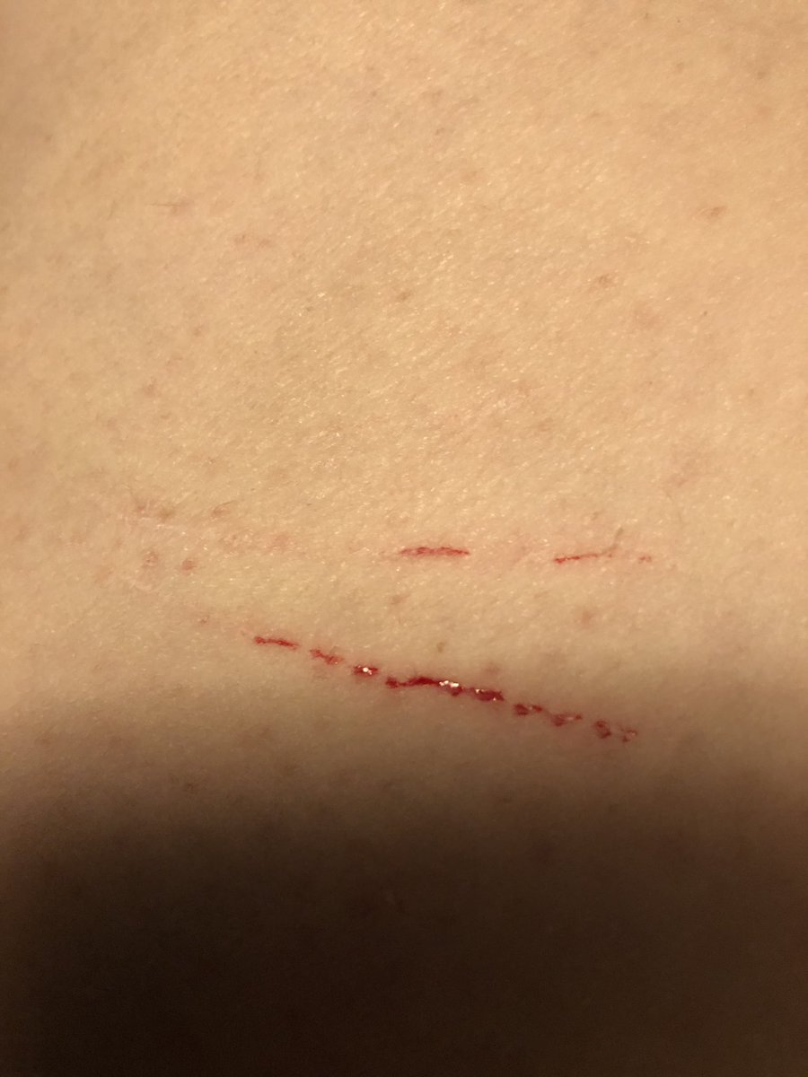 prickly12516328's tweet photo. Meh scratches are meh.
This is getting old. #assholecats https://t.co/oeiS8bD2m9