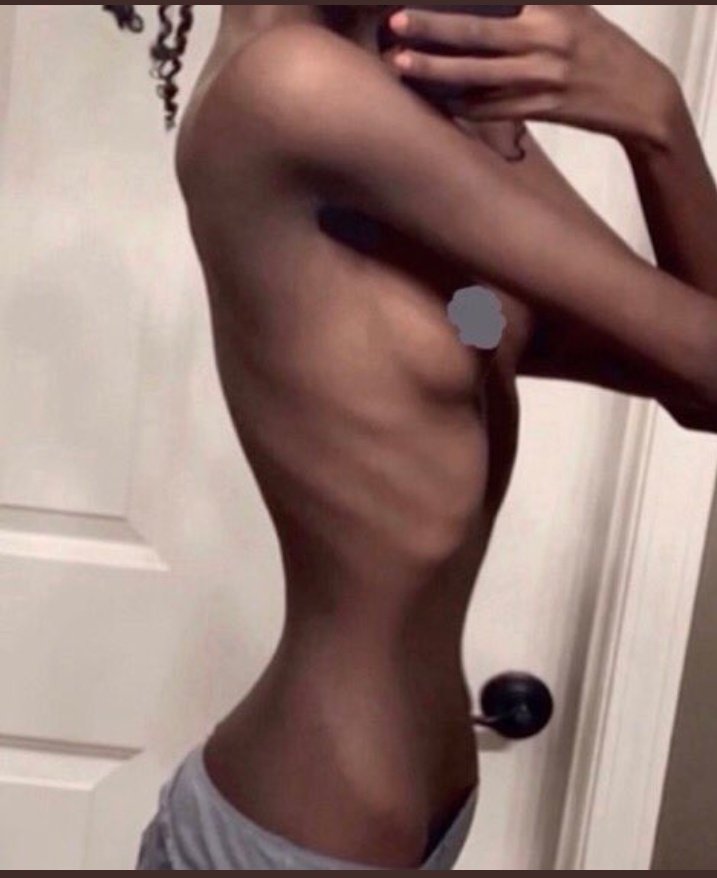 Good_bye0069's tweet photo. Need more black girl thinspO because I really love to see it
♡
♡
♡
♡
♡
NOT MINE! #TW #TikTok #Thinsp0
NOT the same gurl✪ https://t.co/2ArrAGfRZr