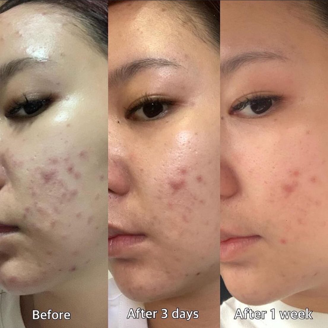 BellaAuraSkin's tweet photo. Powerful skincare + Proven science = Pure Results 
Learn more about our Rapid Repair Clarifying Elixir at https://t.co/q1Wm42hlXO #acne #HealthyLiving #skincareroutine #ScienceTwitter https://t.co/rrGDWMFMdO