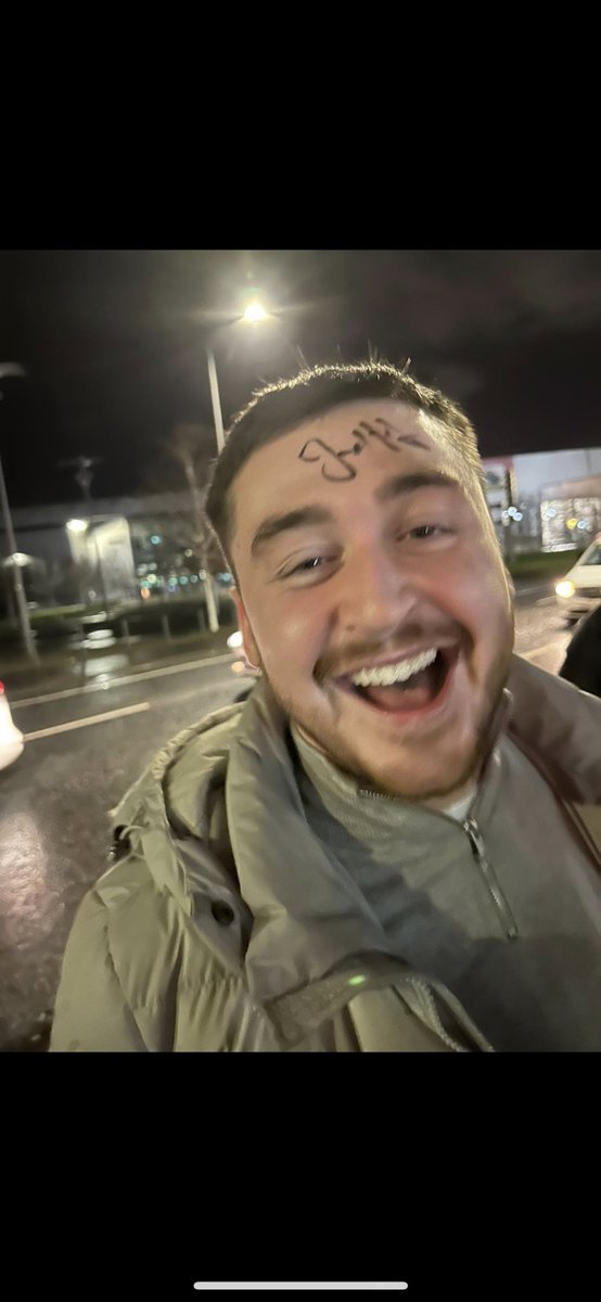 Lewiscareyy's tweet photo. Mates went for a pint after the game before going to the motor n by time he left the pub he’s walked out past the stadium n Joe Hart is driving out n he’s took a permy marker off a wee guy n got him to sign his head😂😂😂😂 https://t.co/Gp6T0NNtbo