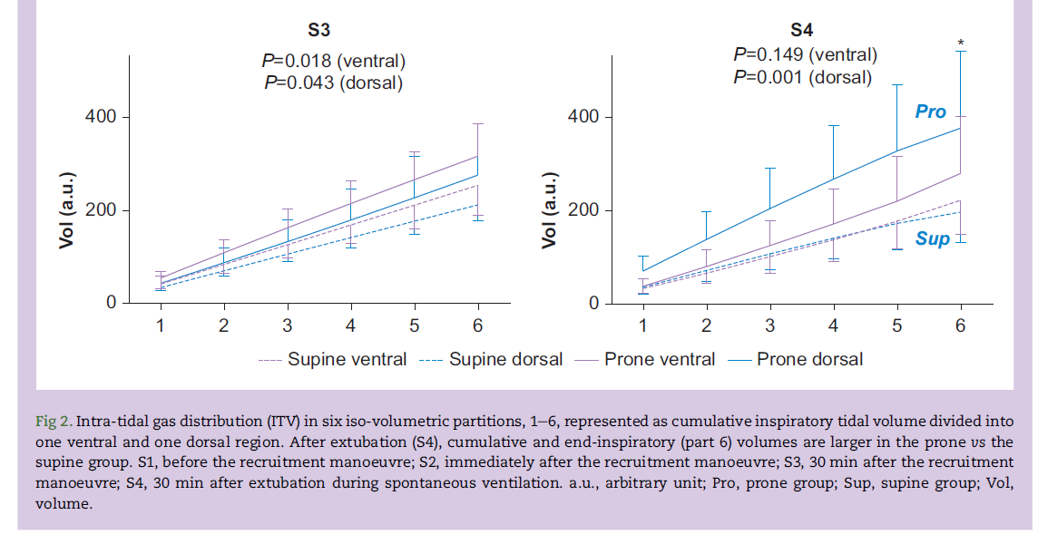 commerepmx's tweet photo. Prone position performed by expert teams, improves alveolar recruitment maneuvers and prevents pulmonary complications in cardiovascular and orthopedic surgeries. 🫁🫀🦴🩺🧑‍⚕️.
doi: 10.1016/j.bjao.2022.100105 https://t.co/SBumActrFS