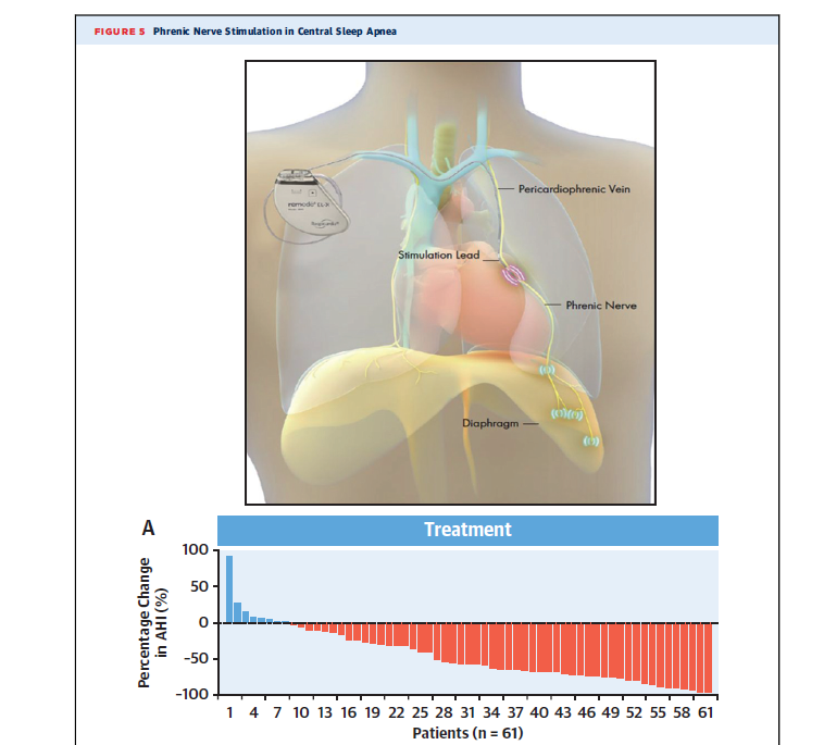 commerepmx's tweet photo. The training of the main respiratory muscle, a new strategy to improve the physical capacity of patients with heart failure. 🫀🫁🩺🧑‍⚕️.
https://t.co/fh9AZzu2bE https://t.co/M6hM6dnfWJ
