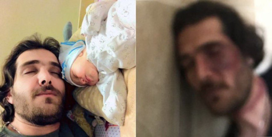 Rahaaaa____'s tweet photo. These pictures are of #HassanFirouzi, showing how severely he’s been tortured. His family has been told that once he gets better, he’ll be EXECUTED!
Please be his voice. His life's in DANGER.
#MahsaAmini https://t.co/sHkouWKvDX
