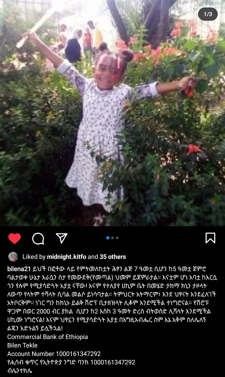 እጅግ በጣም ቀላል ነው እንተባበር 🙏
