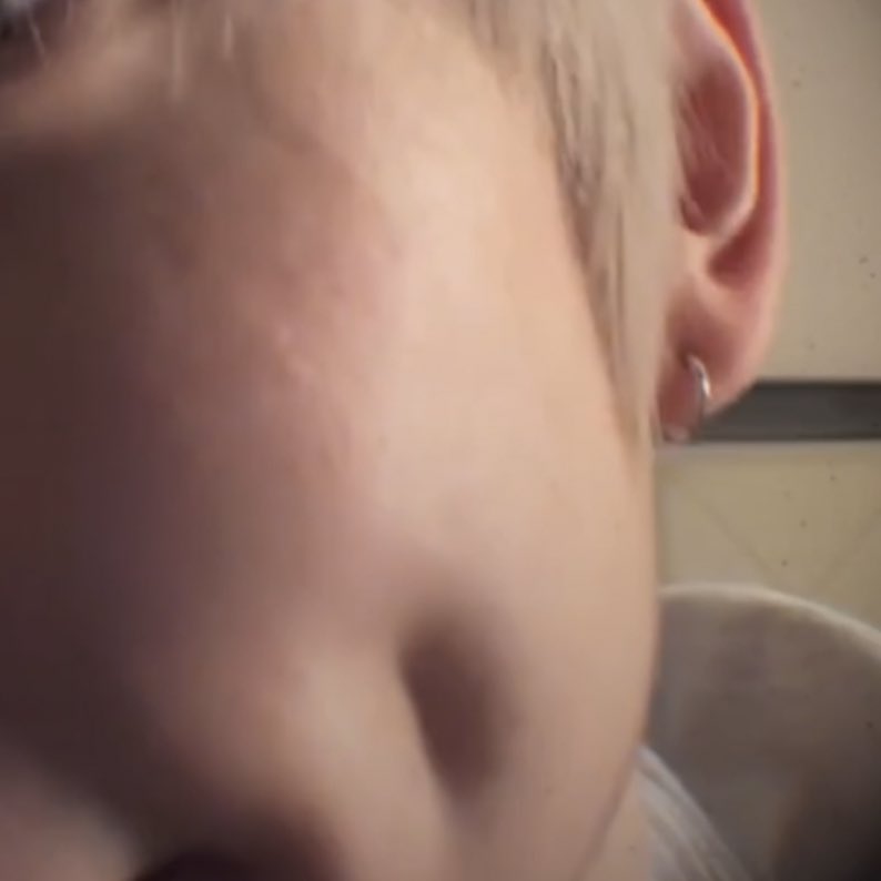 보조개 진짜 실환가