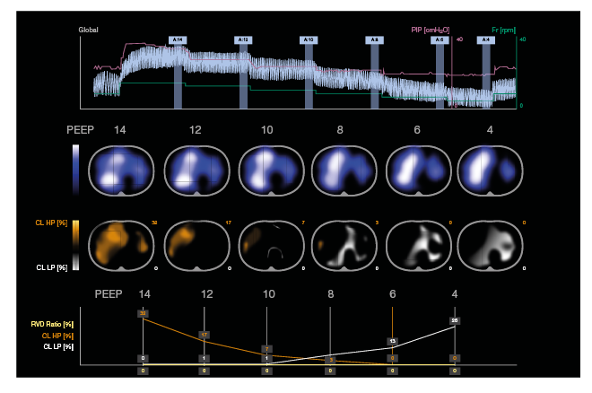 ⭐️VENTILACIÓN MECÁNICA PEDIÁTRICA Y NEONATAL. Nueva Edición
📅 Inicio 1 de febrero de 2023
💻100% ONLINE
ℹ️ Toda la Información: formacionpediatrica.online/index.php/9-cu…
👉Abierta Inscripción: formacionpediatrica.online/index.php/insc…