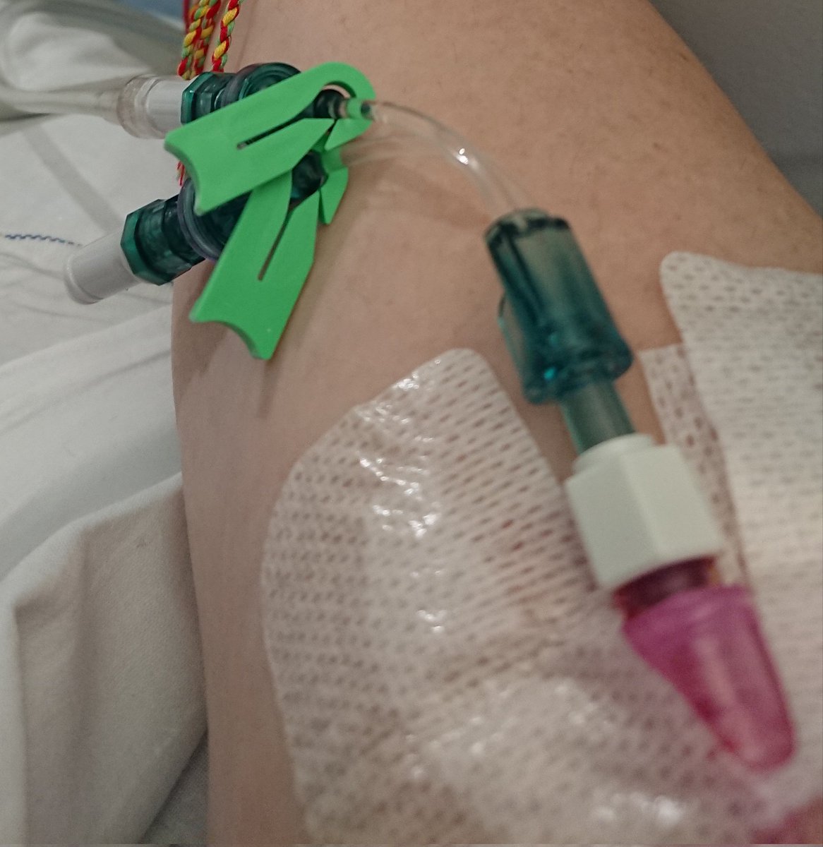 Helenathanicky1's tweet photo. This is not on I am in hospital and have to share a cubicle on the ward, the bay I am on is a 6 bed bay with 7 in it xx https://t.co/OBQurHqnSA
