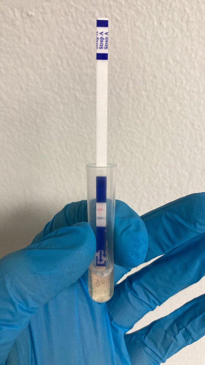 FormacionCalzad's tweet photo. Comenzamos el año con un caso clínico 🩺👇🏻🧵

“¡Doctor, a mi hijo le duele la garganta, vengo a que le hagan un test!" https://t.co/1U0iloqO8E