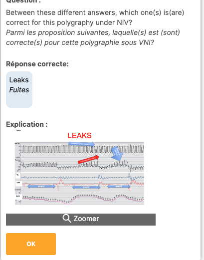 New quizz, new traces with more details in the answers...the new 2023 traces are here socrative.com Classroom : SOMNONIV2023